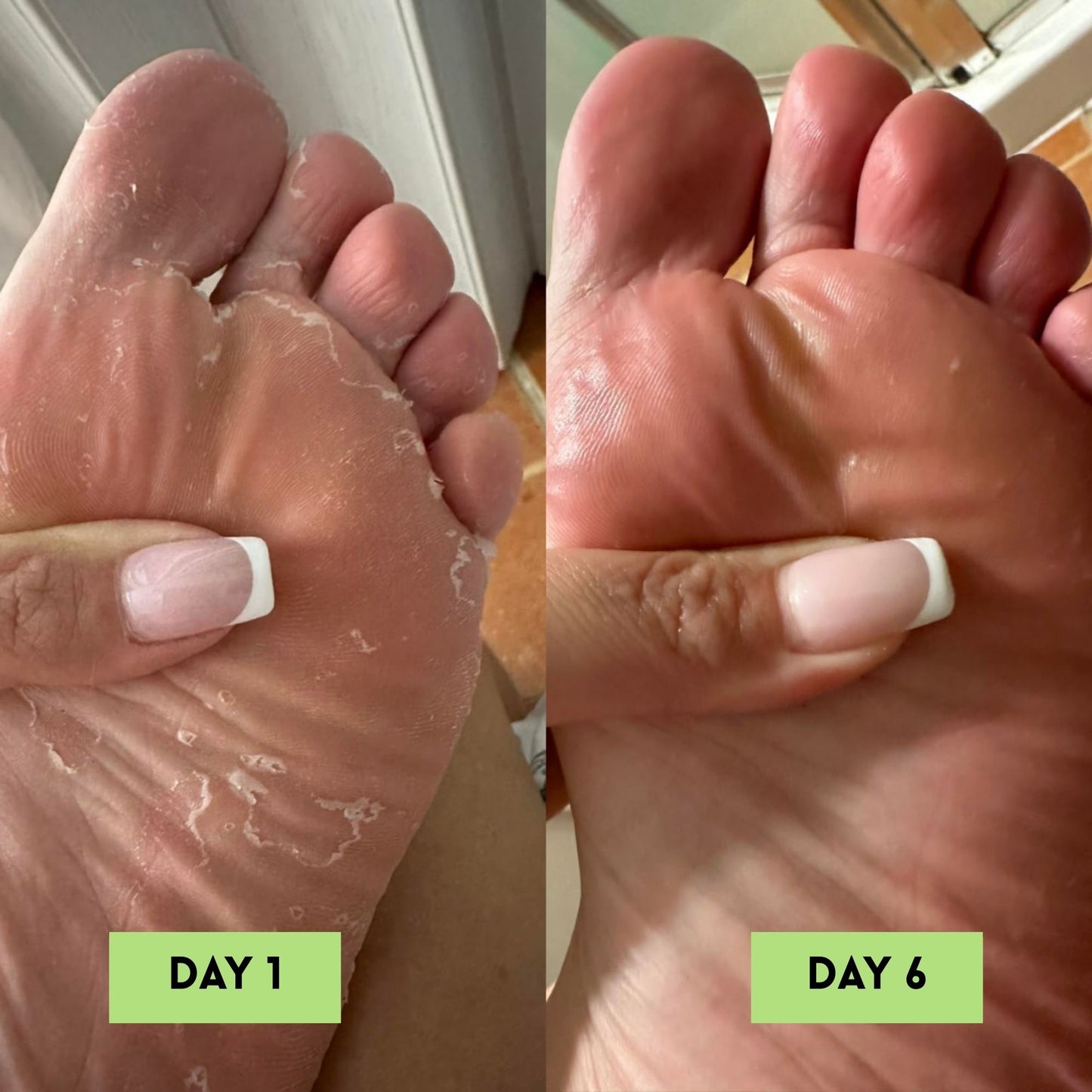 Tea Tree Oil AntiFungal Soap