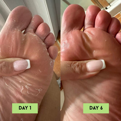 Tea Tree Oil AntiFungal Soap