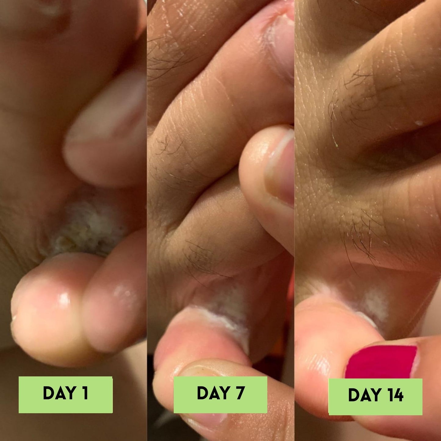 Tea Tree Oil AntiFungal Soap